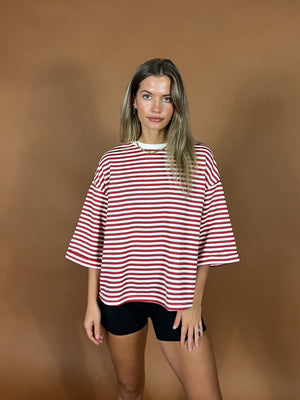 Backup Stripe Top